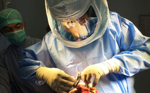 Arthroscopic Surgery in delhi