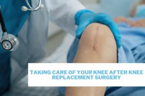 featured Image - Taking care of your knee after knee surgery