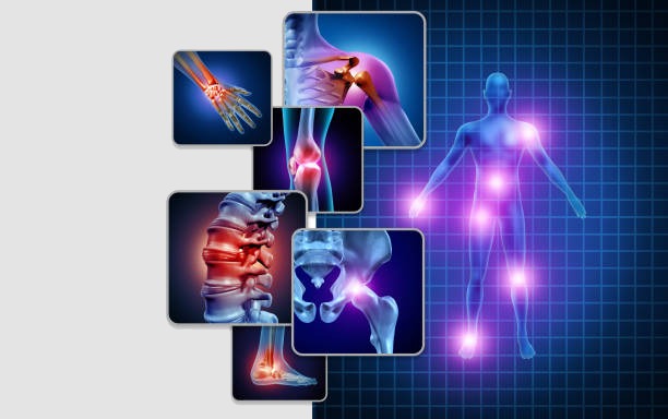Work Related Injuries in Orthopedics