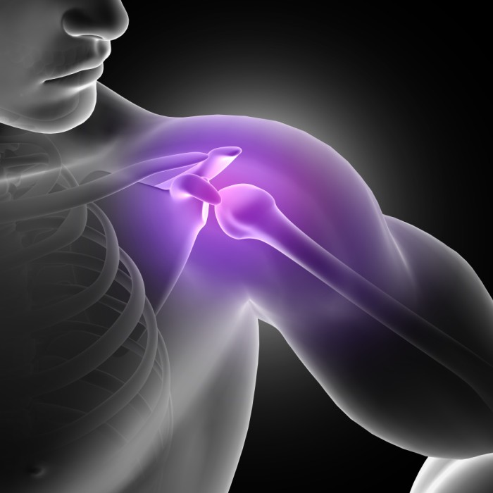 Shoulder Replacement Surgery Cost
