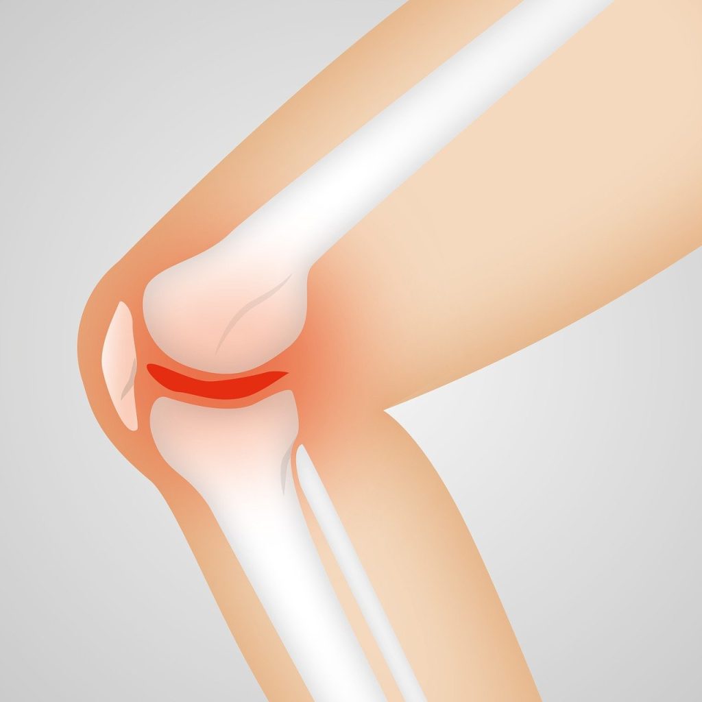 Knee Replacement Surgery Cost